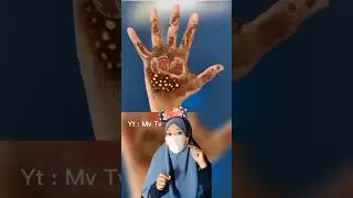 kompilasi kumpulan asmr perawatan macam - macam luka |Mv 