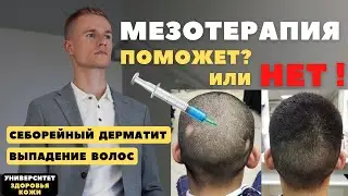 Мезотерапия - лечение  себорейного дерматита на голове и выпадения волос?