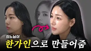 이 의느님은 다 해줍니다. 알잘딱깔센으로 한가인 만들어주심💆🏻‍♀🥰✨| 이마거상+듀얼트임+콧대+코끝+매부리+복코교정