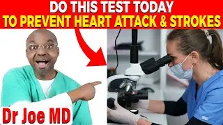 THIS BLOOD TEST COULD SAVE YOUR LIFE! (New Heart Attack Risk Detector!!)