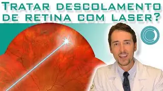 Tratar descolamento de retina com laser - é possivel?