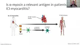 [Margaret L. Axelrod] T cells specific for α-myosin drive immunotherapy-related myocarditis