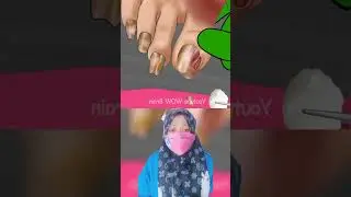 Kompilasi Kumpulan Asmr Animasi perawatan Muka Banyak Ulatnya |Mv 