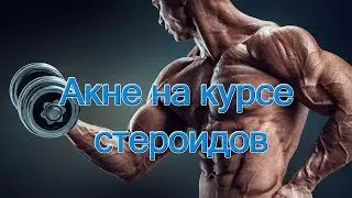 Акне на курсе стероидов