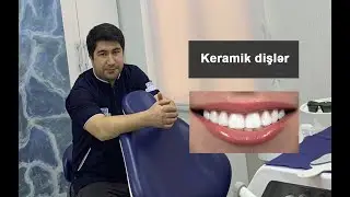 Keramik dişlər