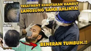 3 PENYEBAB RAMBUT KEBOTAKAN DINI DAN CARA MELEBATKAN RAMBUT TIPIS