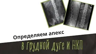 Определяем апекс в грудной дуге и НКП