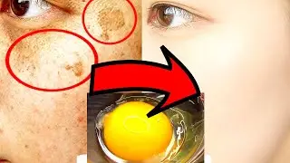 JUST 1 EGG WILL REMOVE STAINS AND WRINKLES WITHOUT PLASTIC! Face Mask from wrinkles Homemade Recipe
