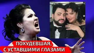 ЗАМЕТНО ПОСТАРЕЛА И СПАЛА С ЛИЦА: МУЖ ВЫСТАВИЛ ФОТО ПОХУДЕВШЕЙ ДО НЕУЗНАВАЕМОСТИ АННЫ НЕТРЕБКО