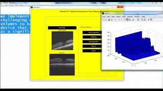 Mini Project on Matlab Program | Mini Thesis on Matlab Program