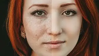 High-End Skin Softening in Photoshop | Remove Blemishes, Dark Spots| Easily remove Acne in Photoshop