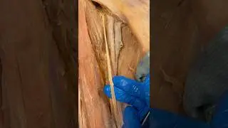 Real Femoral Artery & Nerve!