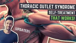 Thoracic Outlet Syndrome Treatment That WORKS (Updated)