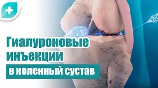 Гиалуроновые инъекции в коленный сустав