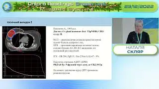 Наталія Скляр - Сучасні підходи до променевої терапії раку молочної залози.