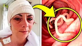 Woman Hears Noises in Her Head for Years  So Doctors Discover the Truth