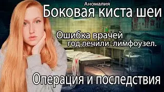 Боковая киста шеи. Ошибка врачей-год лечили лимфоузлы. Операция и последствия🔪