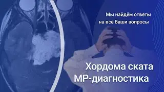 Внутричерепная хордома