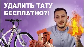 Как удалить татуировку бесплатно в домашних условиях? Соколов Лазер