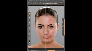 Photoshop'ta yüz sivilce temizleme 
