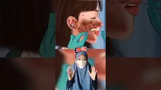 Kompilasi Kumpulan Asmr Animasi luka bakar |Mv #shorts