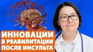 Иновационные технологии для РЕАБИЛИТАЦИЯ ПОСЛЕ ИНСУЛЬТА! // #zdravclinic