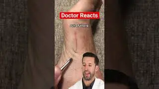 ER Doctor REACTS to 
