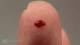 Benefits of Brewers Yeast for Diabetes