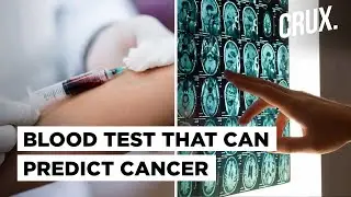 Cancer Breakthrough? Blood Test Can Diagnose Cancer In Earliest Stage Or Tell Youre Safe For A Year