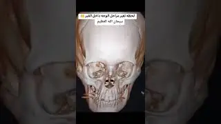 لحظة تغير مراحل الوجه في القبر
