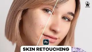 how to Remove Skin Blemishes in Photoshop |  Skin Retouching | Skin Softning | Photoshop Tutorial
