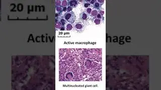 3 Minute NEET PG Prep Videos with Dr Murali Bharadwaz on Incus App . Upload Share Like Fan Videos