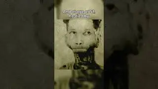 Strangest ways people have died💀 