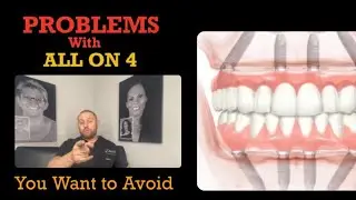 Problems with ALL ON 4 Dental Implants