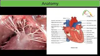 Mitral Regurgitation || What should you know || USMLE exam