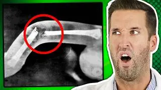The Most Shocking Sex Injuries