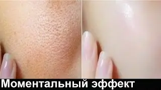 Очищающая и ОТБЕЛИВАЮЩАЯ МАСКА для Жирной кожи лица