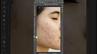 Repair skin in Photoshop 💡🔥 #shorts #photoshoptutorial