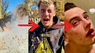 How I nearly lost my eyesight... from a TikTok