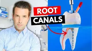 Root Canal Facts 