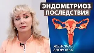 Эндометриоз: что это такое и как его лечить?