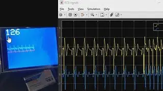 How to Build a Heart Rate Detector Using Arduino and MATLAB