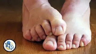 Why Do Feet Smell?