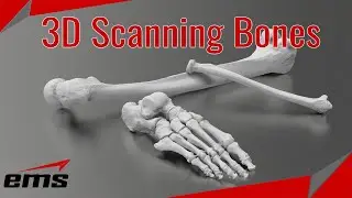 3D Scanning Bones