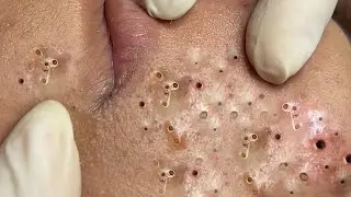 Relaxing Everyday With Loan Nguyen Skincare