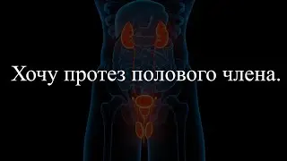ХОЧУ ПРОТЕЗ ПОЛОВОГО ЧЛЕНА.