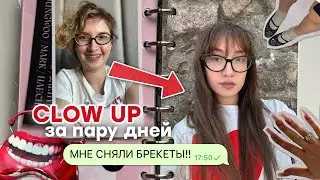 GLOW UP за пару дней! СНЯЛИ БРЕКЕТЫ, новый цвет волос и НОВЫЕ ОБРАЗЫ