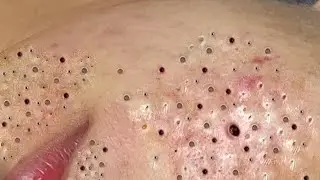 Relaxing Everyday With Loan Nguyen Skincare