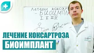 Лечение коксартроза биоимплант bio-osteo