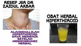 OBAT HERBAL HIPERTIROID || AMPUH MENYEMBUHKAN HIPERTIROID || BERDASARKAN PENGALAMAN PRIBADI